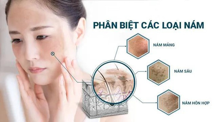 NHỮNG TAI BIẾN THƯỜNG GẶP TRONG TRỊ LIỆU LASER VÀ LÀM THẾ NÀO TRỊ LIỆU THÀNH CÔNG VẤN ĐỀ SẮC TỐ DA.