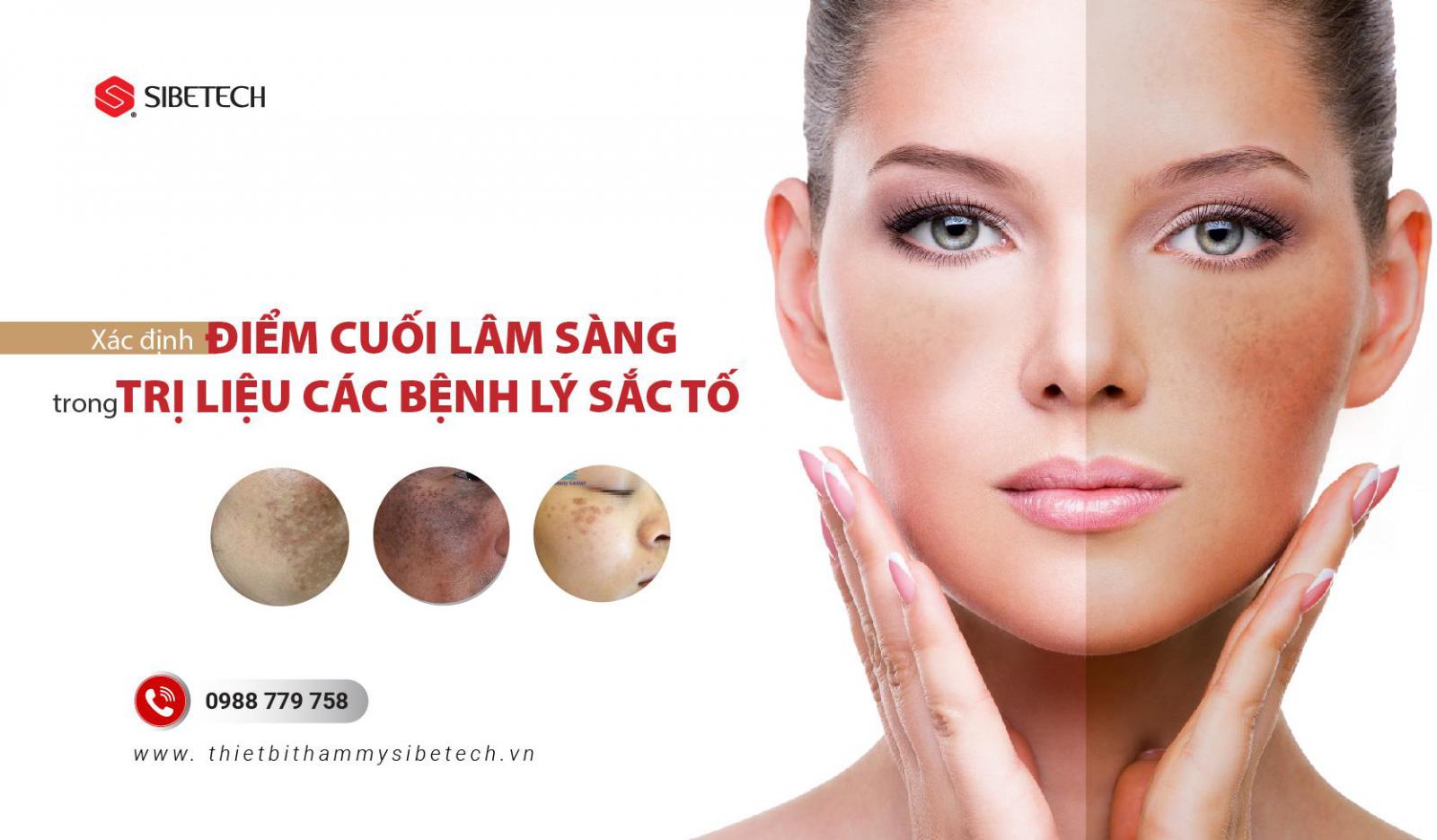 XÁC ĐỊNH ĐIỂM CUỐI LÂM SÀNG TRONG TRỊ LIỆU CÁC BỆNH LÝ SẮC TỐ BẰNG THIẾT BỊ THẨM MỸ CÔNG NGHỆ CAO LASER 