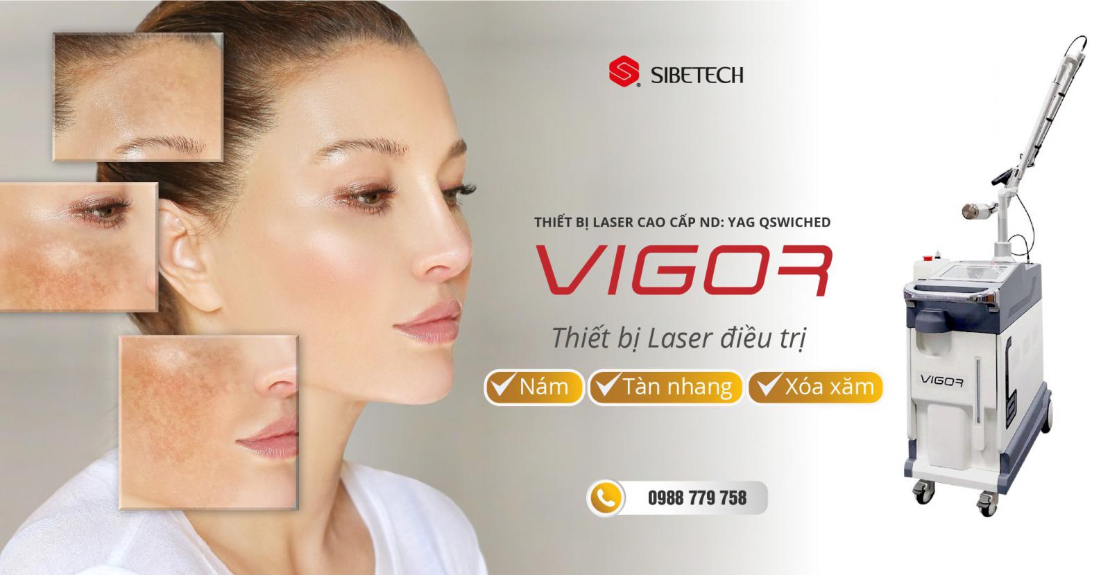 THIẾT BỊ LASER CAO CẤP ND: YAG QSWICHED VIGOR – THIẾT BỊ LASER TRỊ NÁM, TÀN NHANG, XÓA XĂM ĐƯỢC PHÂN PHỐI ĐỘC QUYỀN BỞI SIBETECH VIỆT NAM.